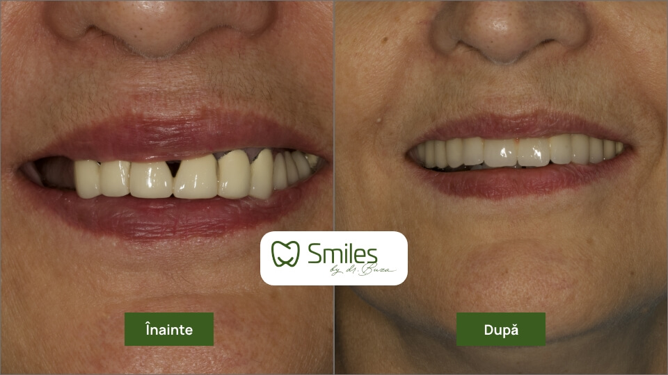 before_after_1 – 1