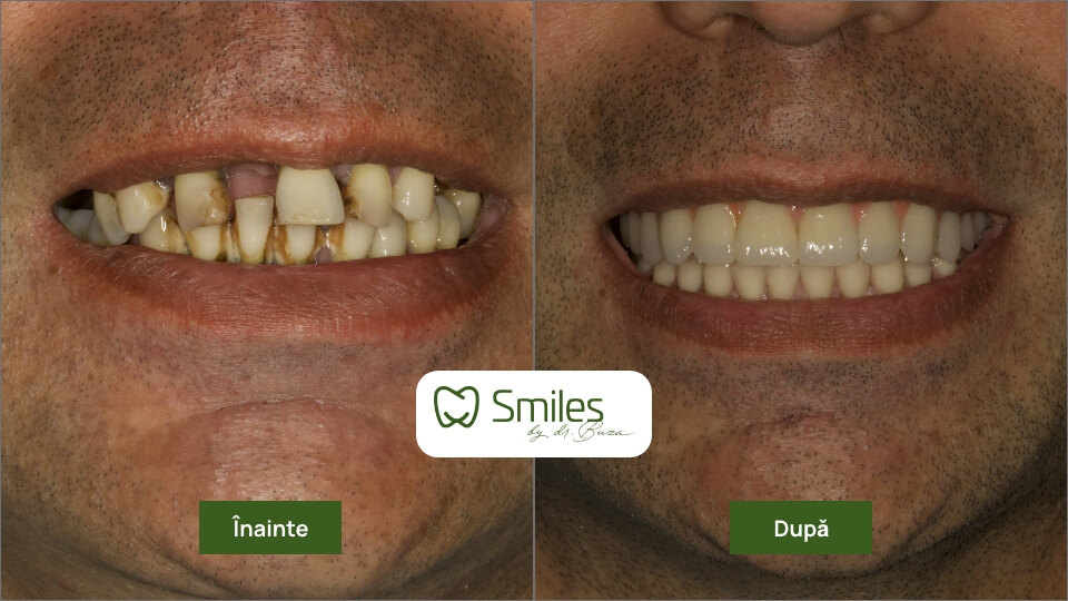 before_after_1 – 3