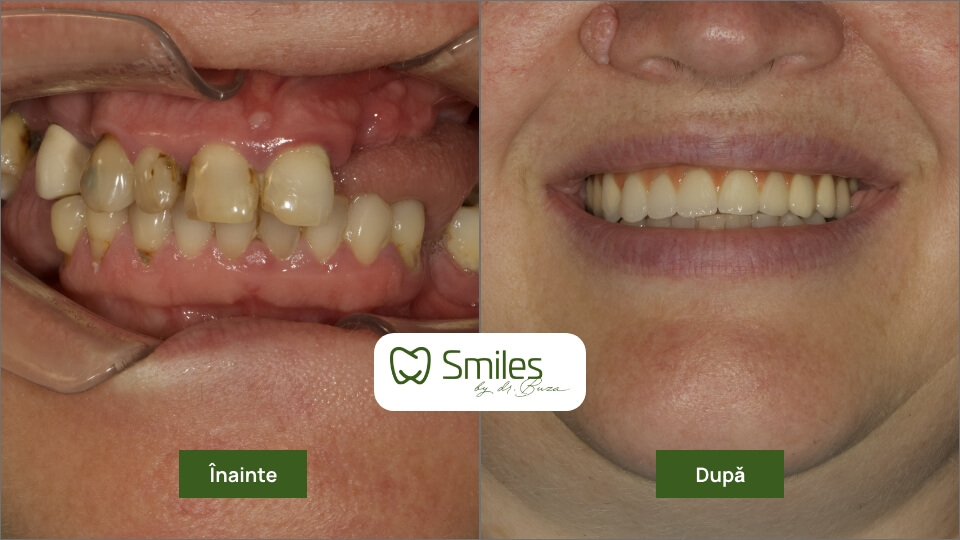 before_after_1 – 4
