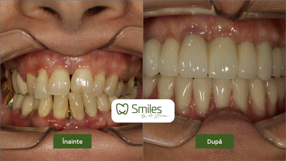 before_after_1 – 6