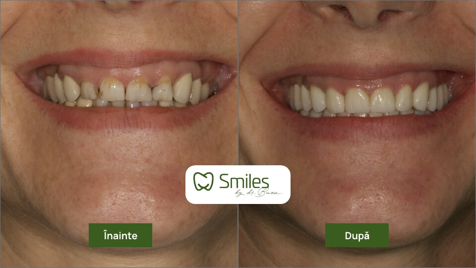 before_after_1 – 8