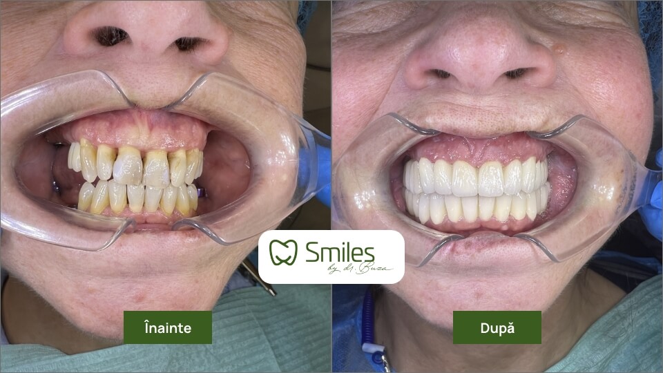 before_after_1